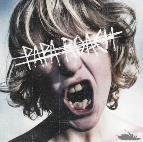 Crooked Teeth